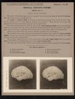 Central Nervous System. Brain - no. 15